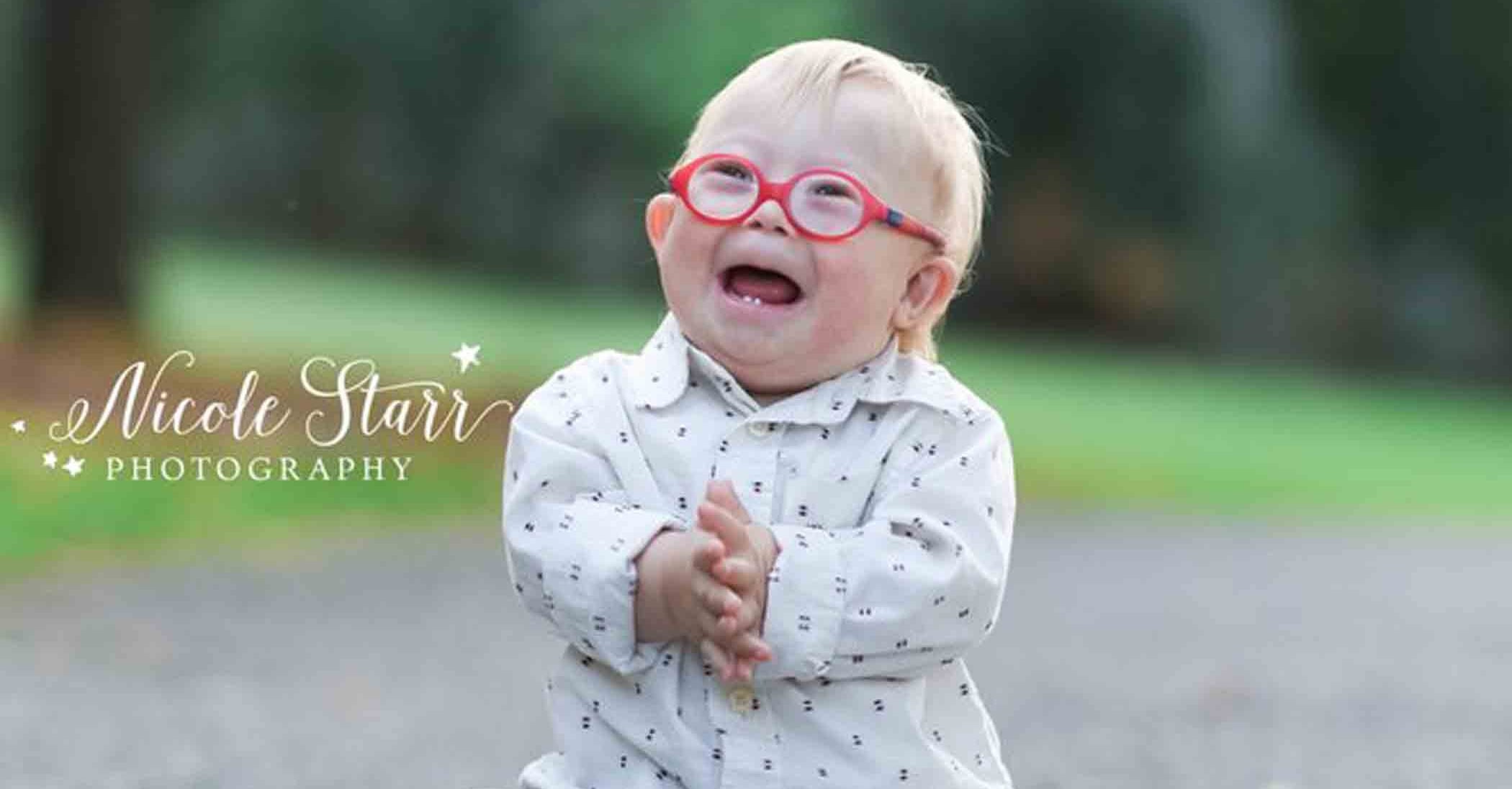 cute down syndrome kids