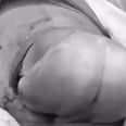 This Is What a "Gentle" C-Section Looks Like — and It's Beyond Incredible