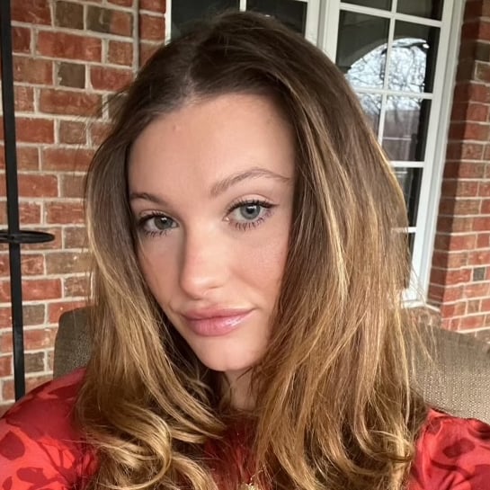 My Hormonal Hair Loss & Regrowth Journey From an IUD