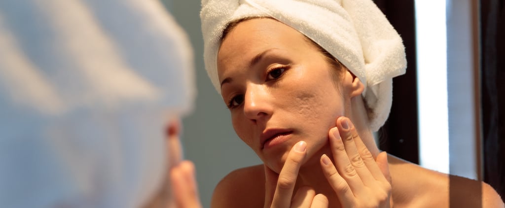 Top Acne Causes and Solutions