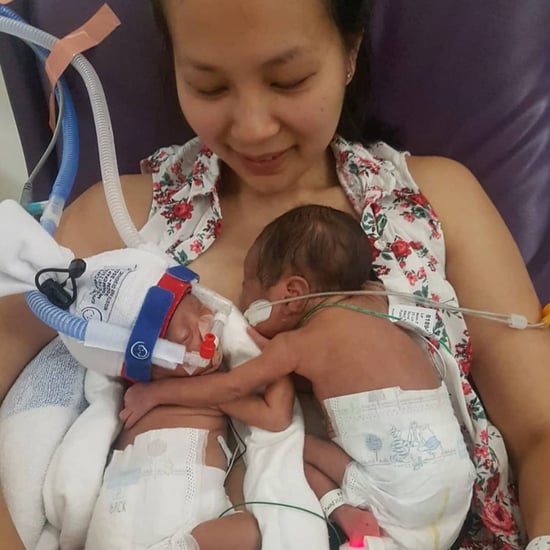 Premature Momo Twins Hug When Meeting For the First Time