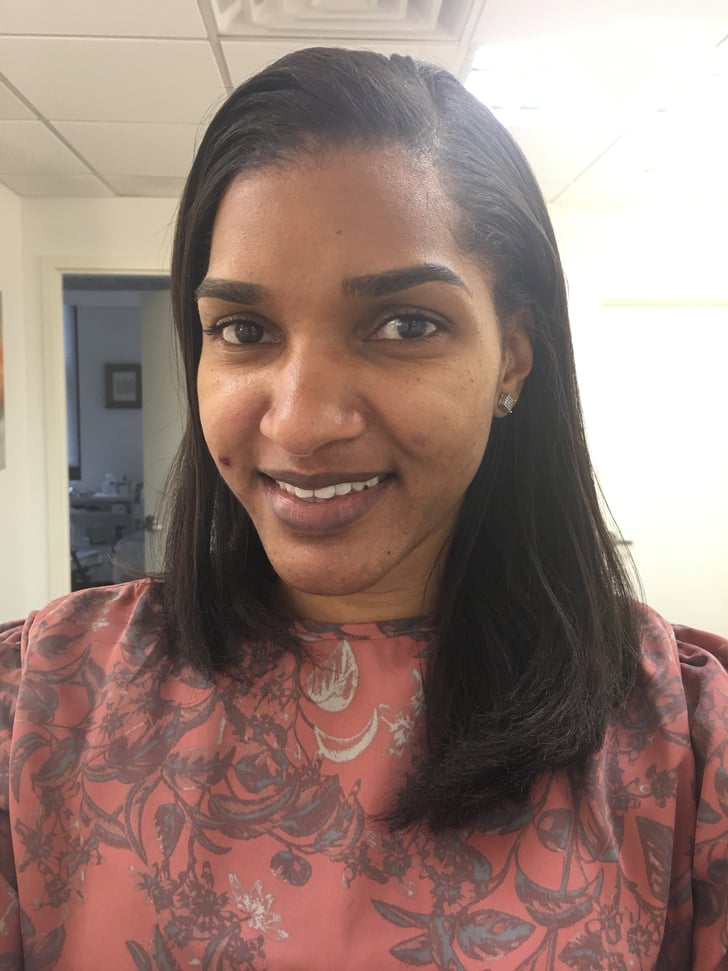 After | Does Electrolysis Work? | POPSUGAR Beauty Photo 5