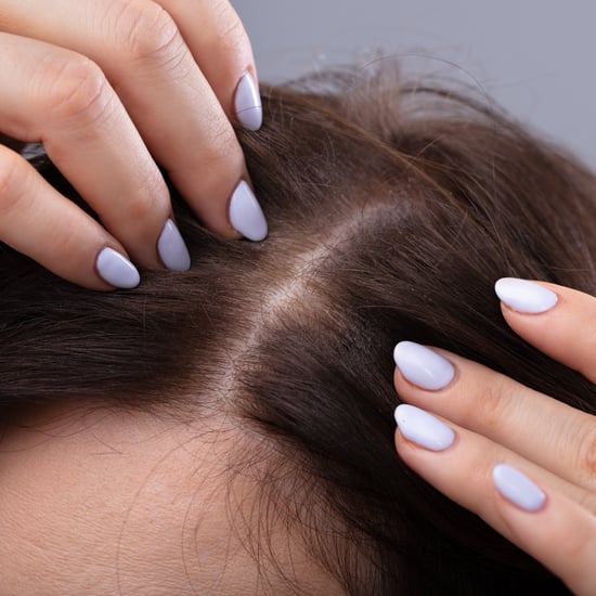 Scalp Psoriasis vs. Dandruff: Experts Explain the Difference