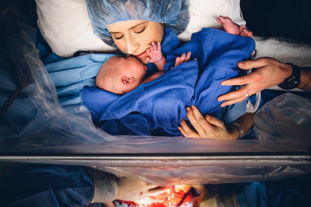 C-Section Birth Photography