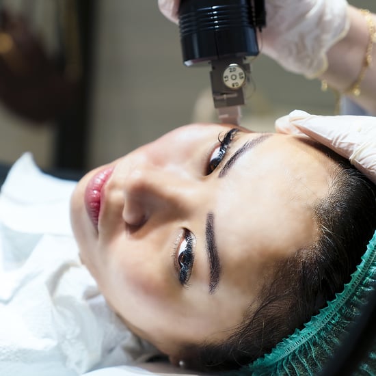 What Is Microneedling? Benefits, Cost, and More