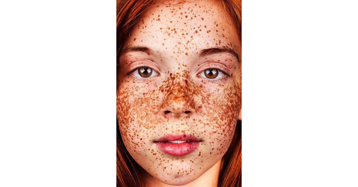 Photos Of People With Freckles Popsugar Beauty Photo 4 