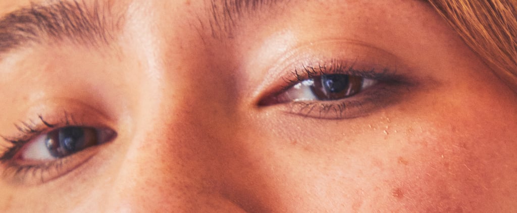 Hypopigmentation: What It Is and How to Treat It, According to a Dermatologist