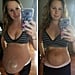 Before and After Pregnancy With Diastasis Recti
