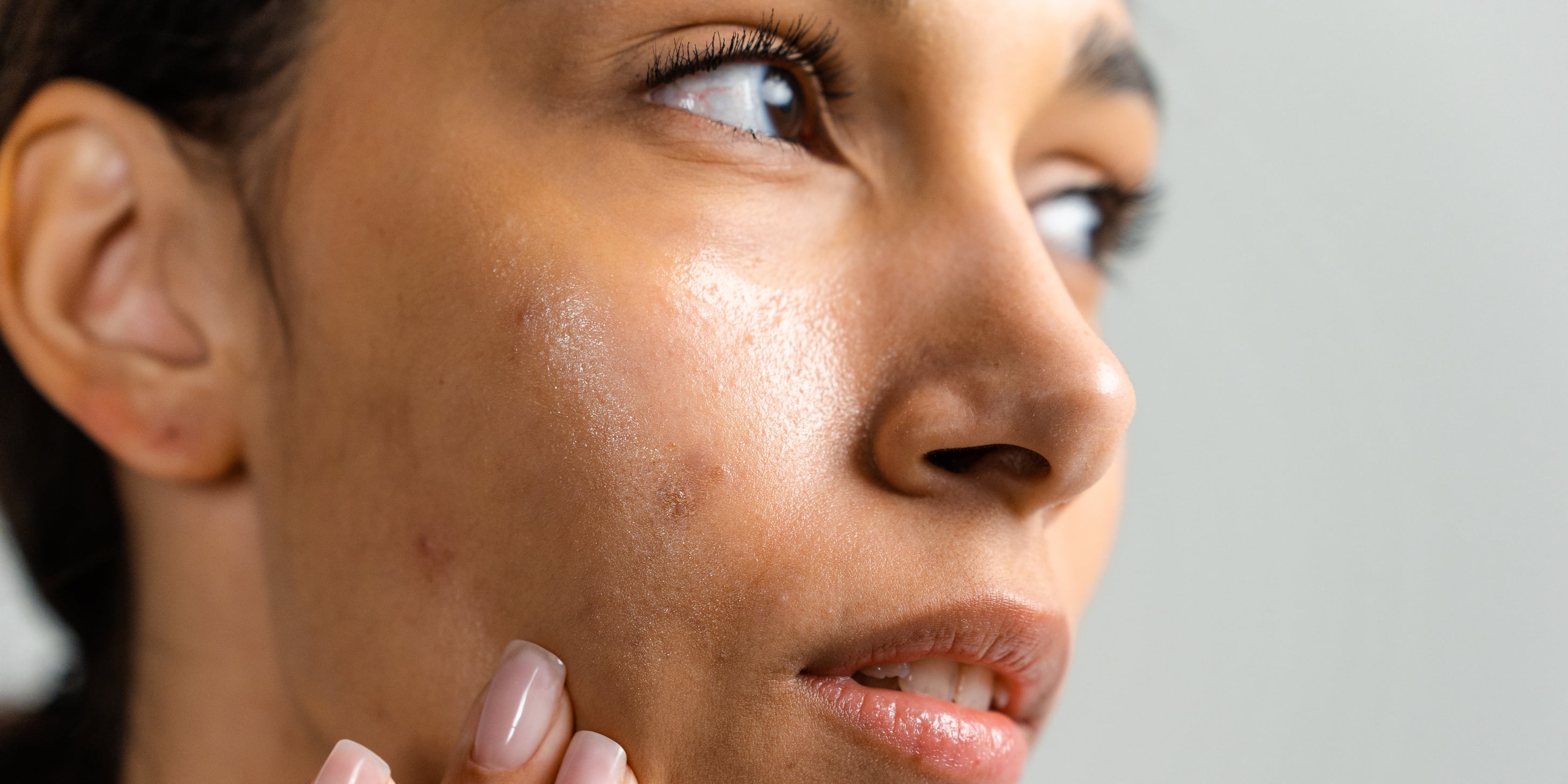Arbutin For Skin: Benefits, How to Use it, and More - Vimarsana News