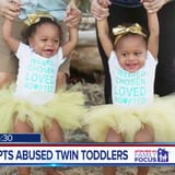 Nurse Adopts Abused Twins From Hospital