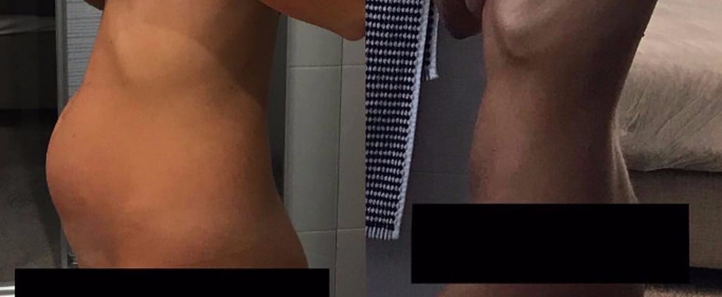 Living With Endometriosis Photos