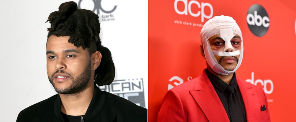 The Weeknd Has Had a Big Beauty Evolution Over the Years