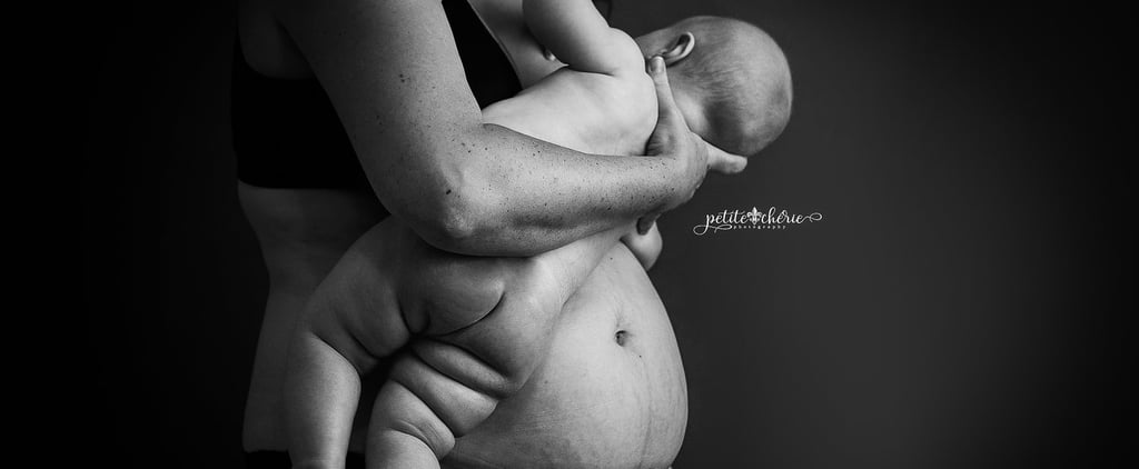 Postpartum Bodies Photo Series