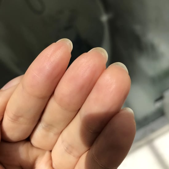 Hyponychium: Experts Explain Skin Growing Under Your Nails
