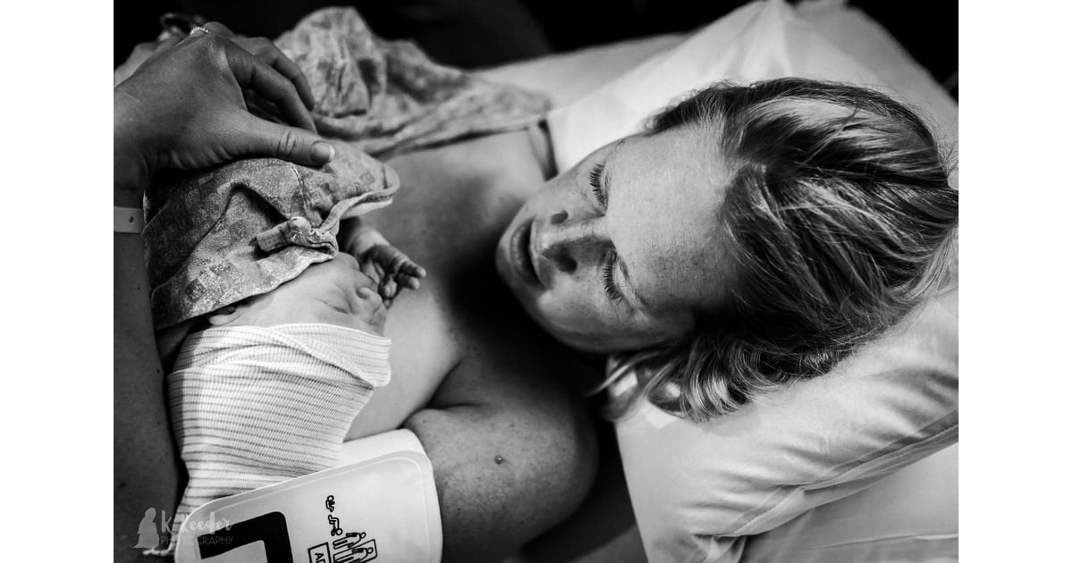 Newborn Head Molding During Birth POPSUGAR Family Photo 7