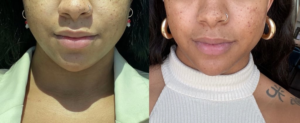 I Tried the Celebrity-Favorite Forma Facial Treatment