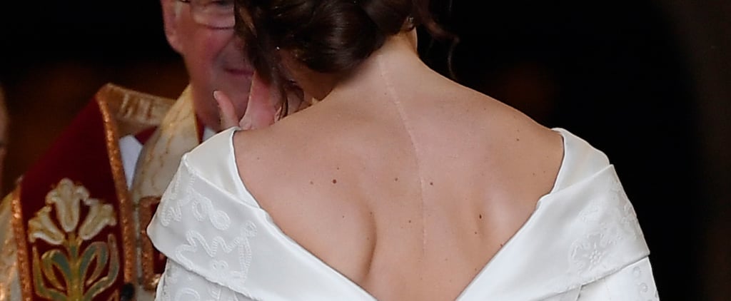 Princess Eugenie Shows Scoliosis Scars at Her Wedding