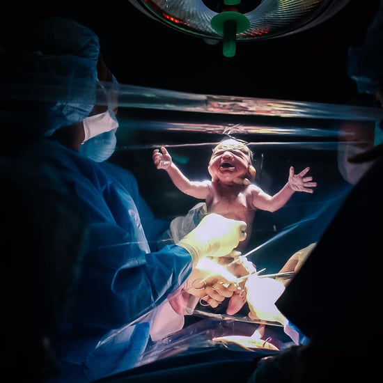 Clear Drapes Family Centered C-Section Birth Photos