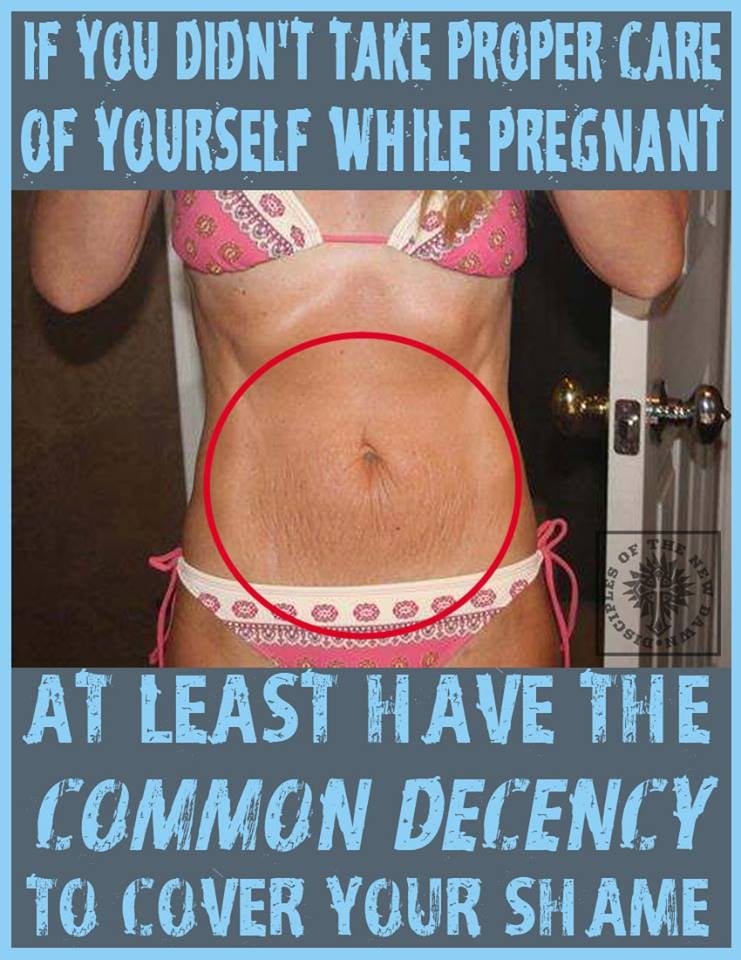 C-Section Shaming Ad Campaign