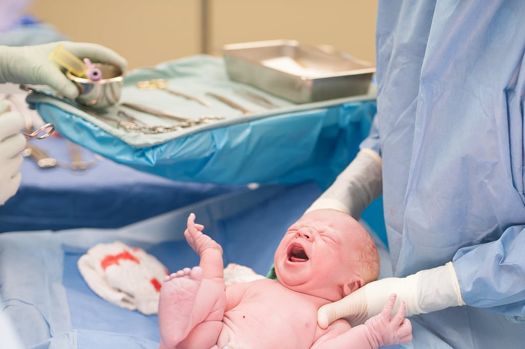 C-Section Birth Photos C-Section Birth Photos