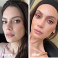 I Got a Celebrity-Beloved "Endo" Brow Lift, and It's Worth the Hype
