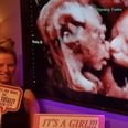 Witness the Magic of Sisterhood as These Twins Kiss During an Ultrasound