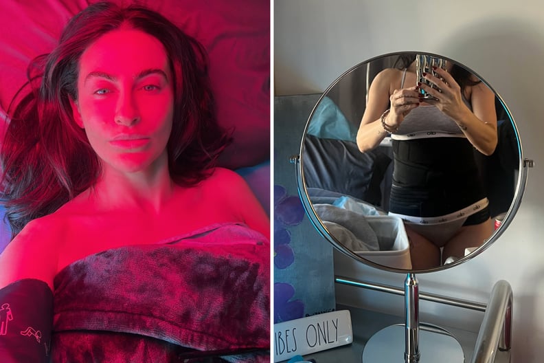 renuvion before and after and review