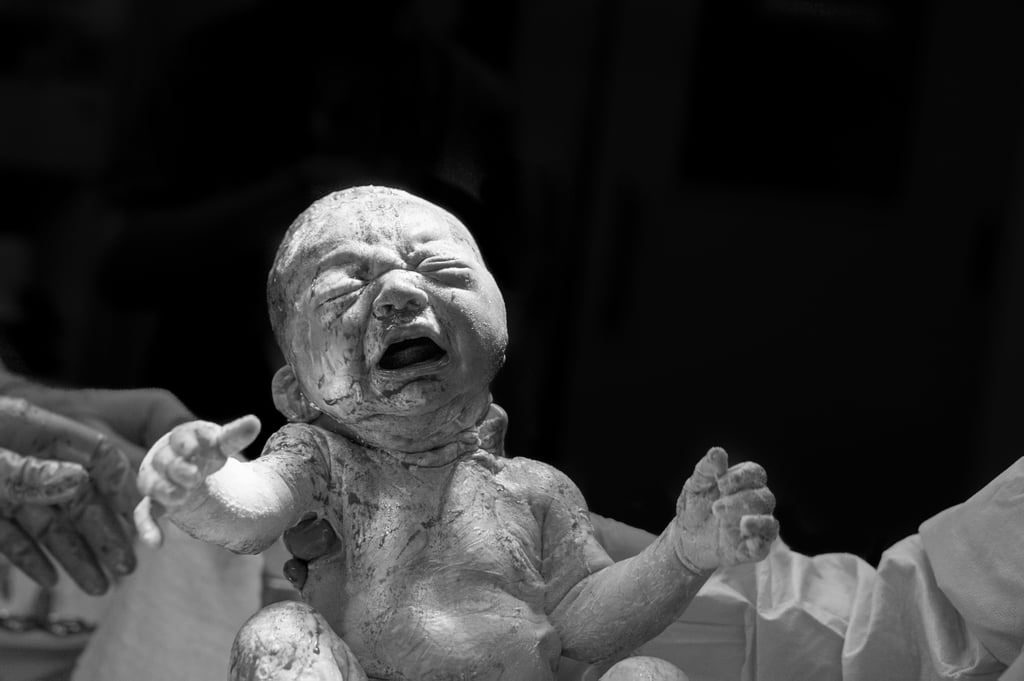 C-Section Birth Story Photo Shoot