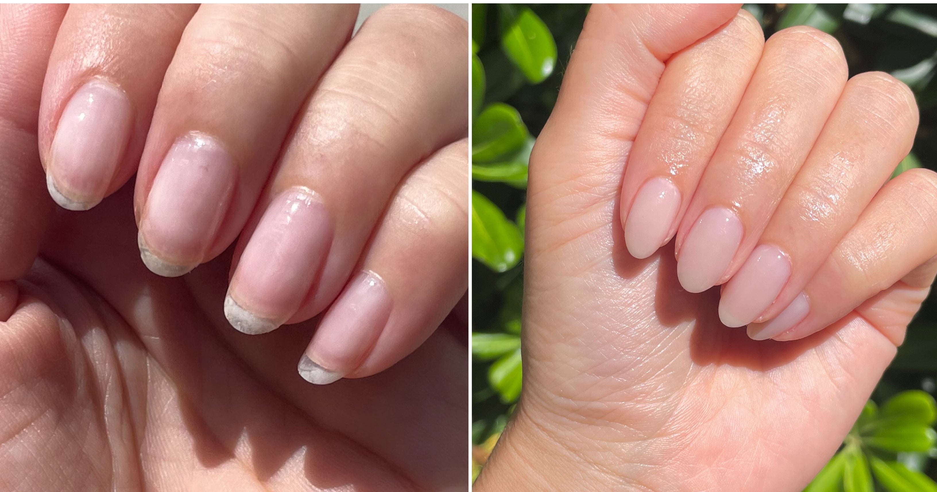 “Nail Cycling” Helped Me Repair Months of Damage