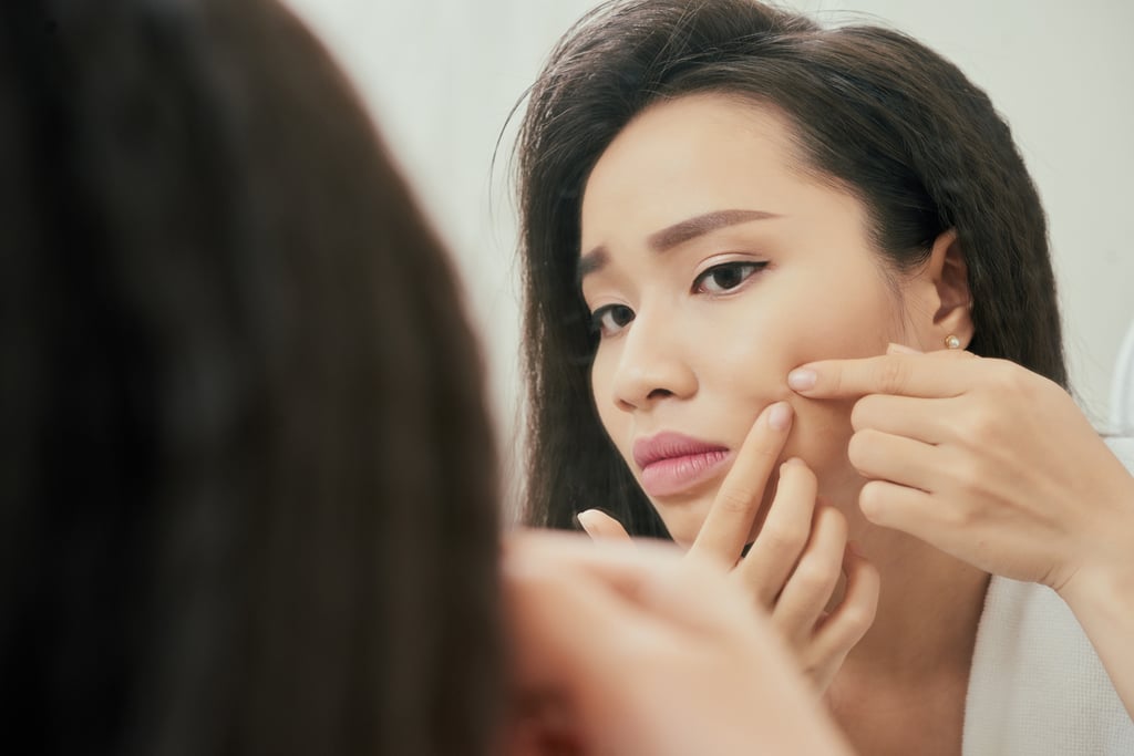 Common Skin-Care Mistake #1: Popping Pimples