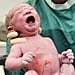 Stop Debating Over C-Sections and Vaginal Births
