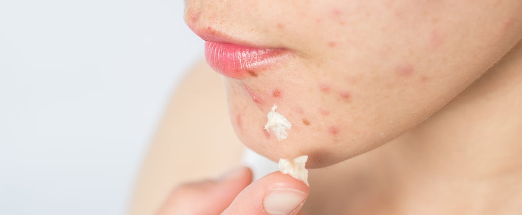 What to Do After Popping a Spot: Tips and Treatments