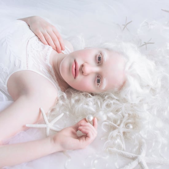 Albinism Photographs Yulia Taits Part 2