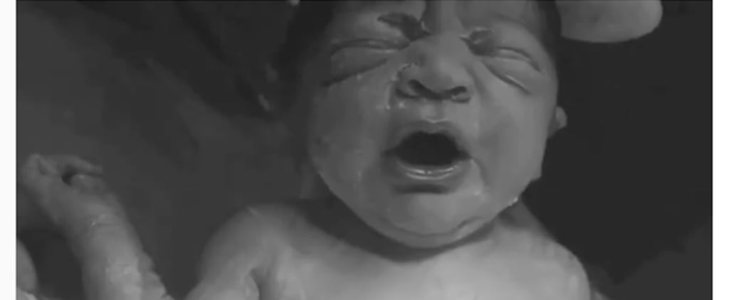 Baby Born Via Gentle C-Section