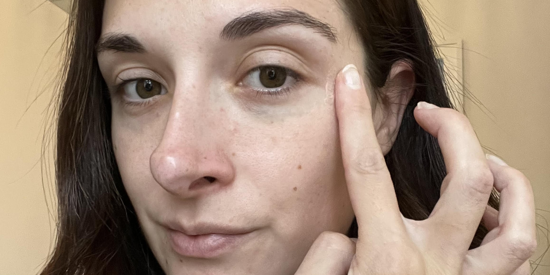 Plump It! No Needles Dermal Filler Review With Photos - Vimarsana News