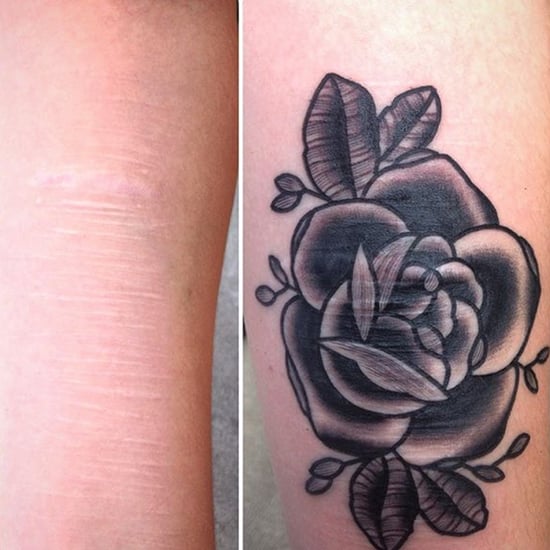 Tattoo Artist Helps People Cover Scars With Tattoos (Video)