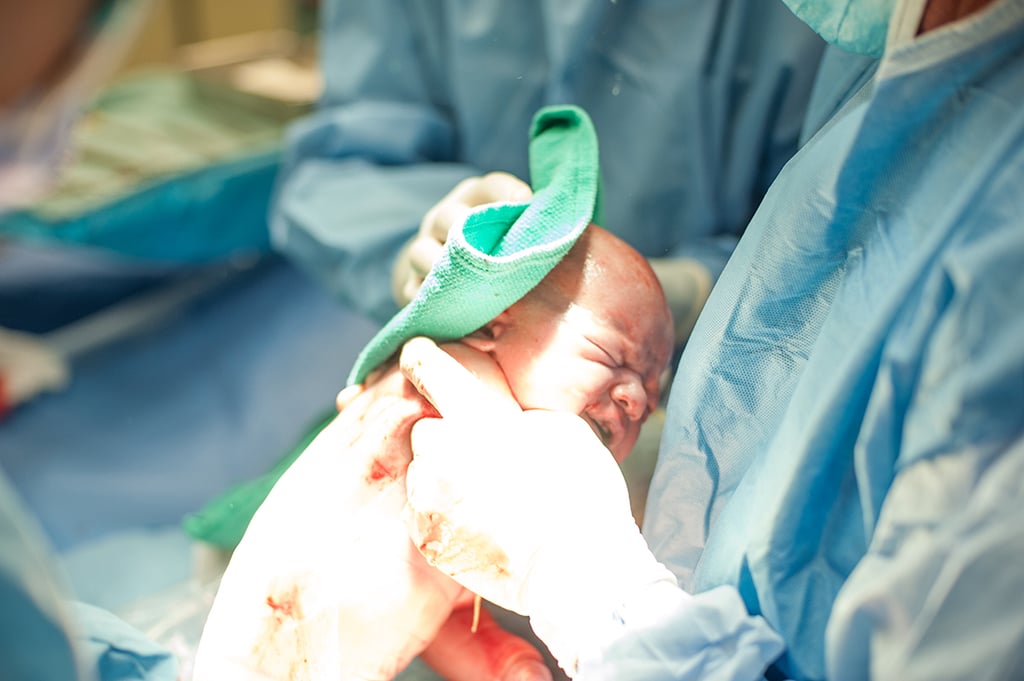 C-Section Birth Photos C-Section Birth Photos