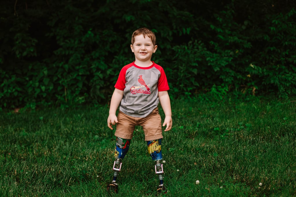 Photo Shoot of Toddler Who Lost Both Legs