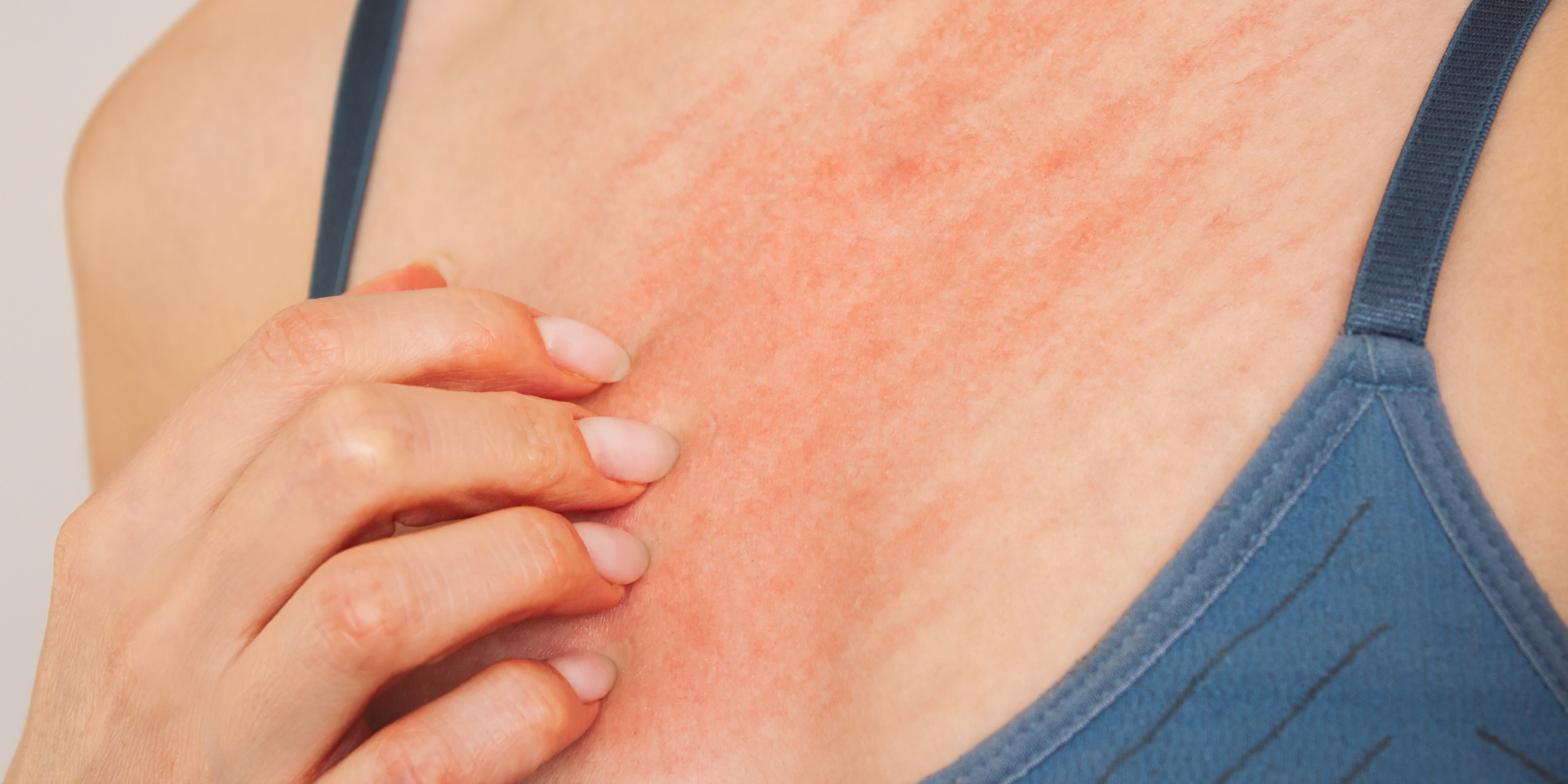 Why Are My Nipples Itchy? | POPSUGAR Health - Vimarsana News