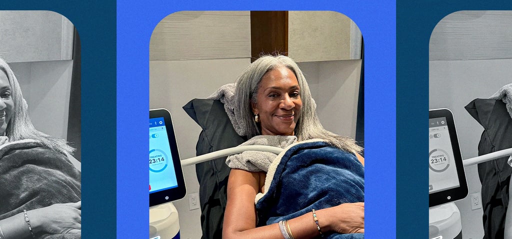 CoolSculpting FAQs From Expert Registered Nurse