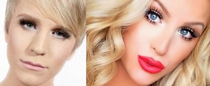 Transgender Surgeries Male-to-Female
