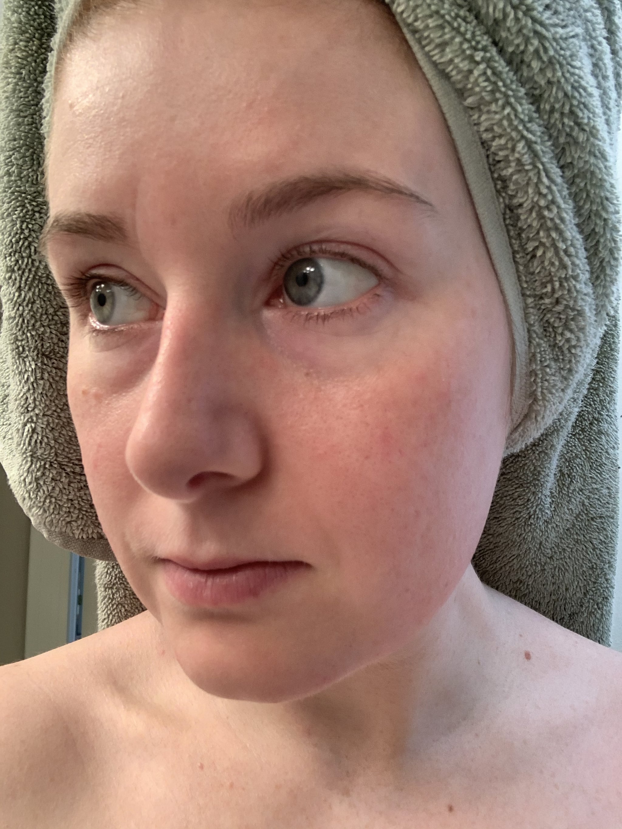 Dermaflash Device Review With Before And After Pictures Popsugar Beauty What did you love about it? dermaflash device review with before