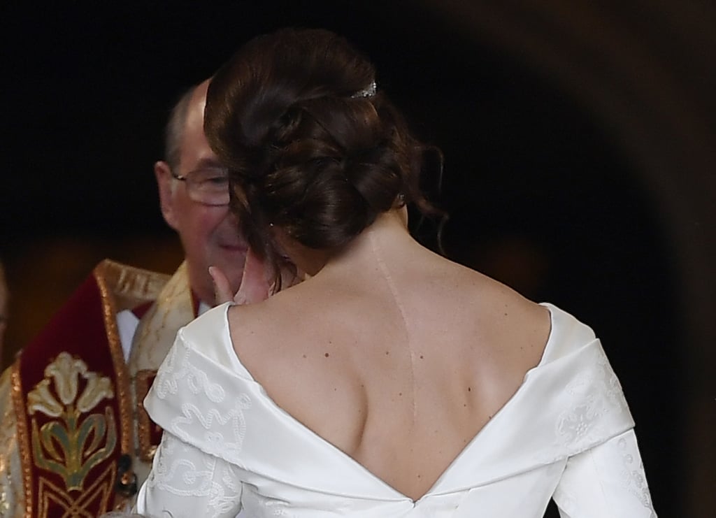 Princess Eugenie Shows Scoliosis Scars at Her Wedding