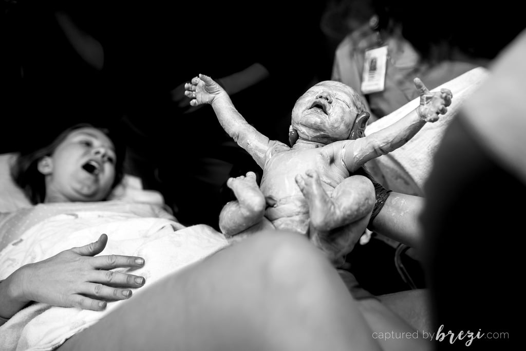 Baby Born En Caul and on Due Date
