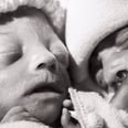 Photo of Premature Twins Meeting For the First and Last Time Will Bring You to Tears