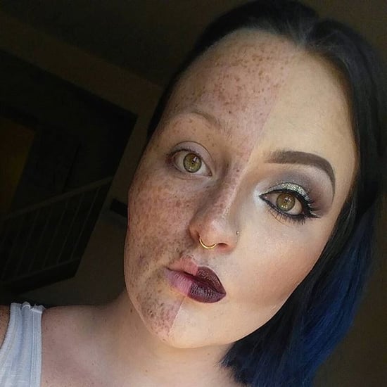 Woman Hides Freckles With Makeup