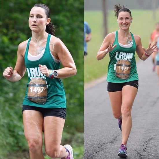 Runner's Side by Side Cellulite Photos