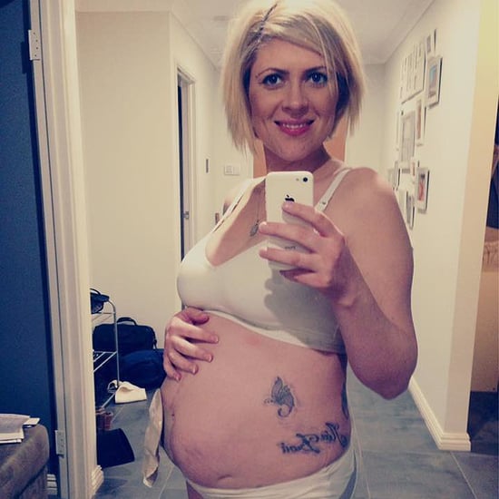 Mom's Selfies With Ileostomy Bag