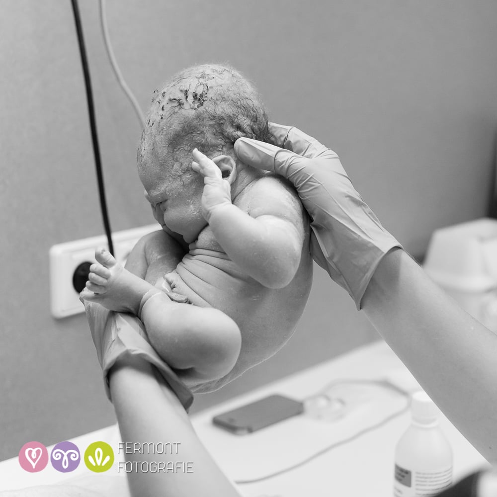 Photos of How Babies Fit Inside of Womb
