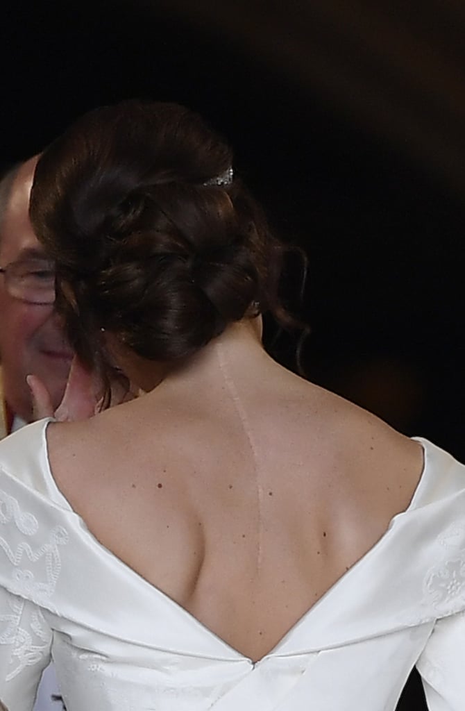 Princess Eugenie Shows Scoliosis Scars at Her Wedding